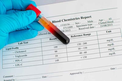 Understanding Blood Test at Home: Glucose Testing
