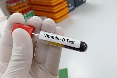 Checking Vitamin D Levels Through Blood Tests at Home