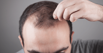 How Much Should You Expect to Pay for Finasteride 1mg?