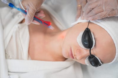 Deep Cleansing Facial with Extraction for Dry Skin: What You Need to Know