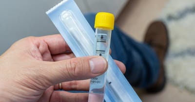 Why Regular STD Tests Are Important for Health
