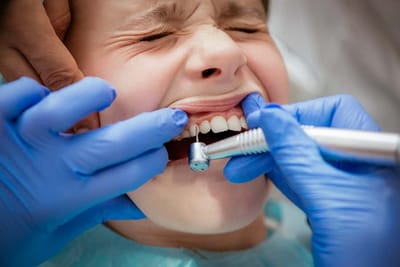 Tooth Filling Cost: Is Composite More Expensive Than Metal?