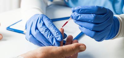 How to Know if You Should Take an STD Test