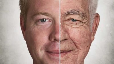Stem Cell Therapy and Aging: Can It Support Longevity?