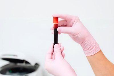 HIV and STD Test: How Often Should You Test?