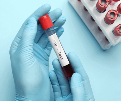 STD Test After Painful Urination: What Could It Be?