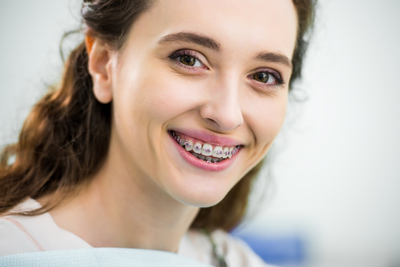 Clear Dental Braces: How They Work and Who Should Use Them