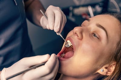 Signs Your Wisdom Tooth Extraction Recovery Is Going Well