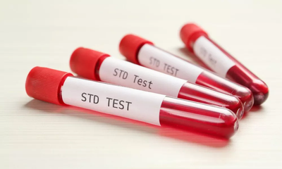 STD Test for Men Who Have Sex with Men