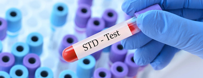 STD Test for Itching, Burning, or Rashes