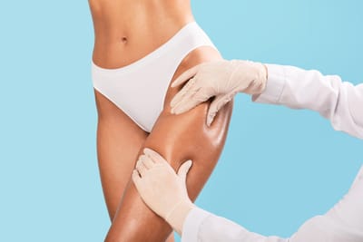 Liposuction for Thigh Fat: What Are the Benefits?