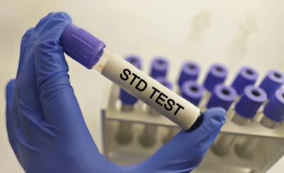 Can You Get an STD Test at an Urgent Care Center?