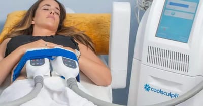 CoolSculpting for Arms: Can It Reduce Arm Fat?