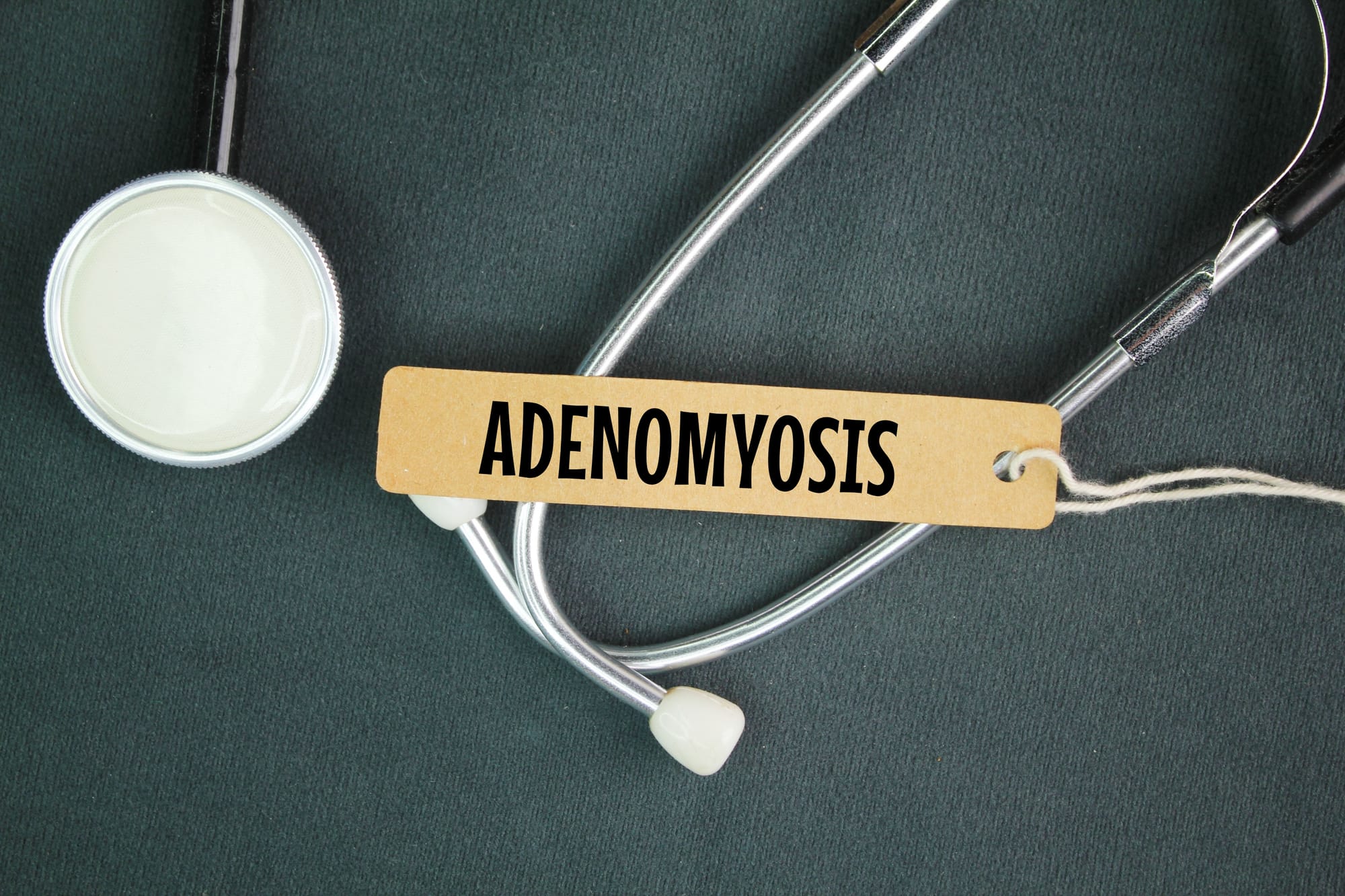 Understanding Adenomyosis: What Every Woman Should Know