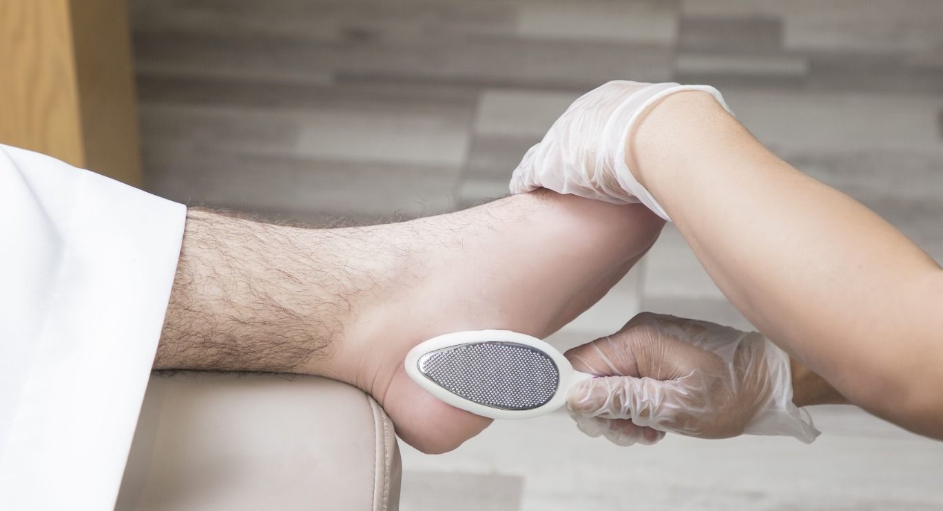 إزالة تشققات الكعبين في أسبوع: طريقة منزلية + أسرع علاج في سبا الرياض