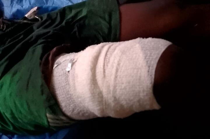 Mambasa : Un cultivateur blessé par un engin explosif à Babila babombi