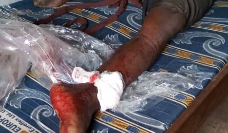 Irumu: Deux dépositaires de Cacao blessés par balle à Walese-vonkutu