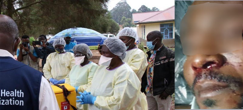 Ituri : les services de santé renforcent la riposte contre le virus d'Ebola