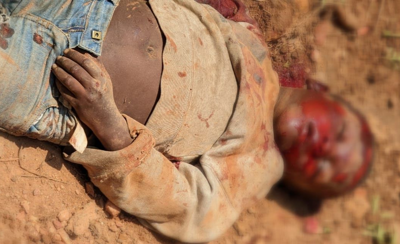 Irumu : un enfant perd la vie dans un accident routier à Mayi Baridi