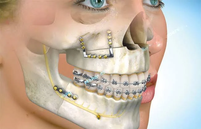 Cirurgia e traumatologia bucomaxilofacial
