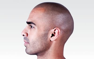 How Realistic Does Scalp Micropigmentation Look?