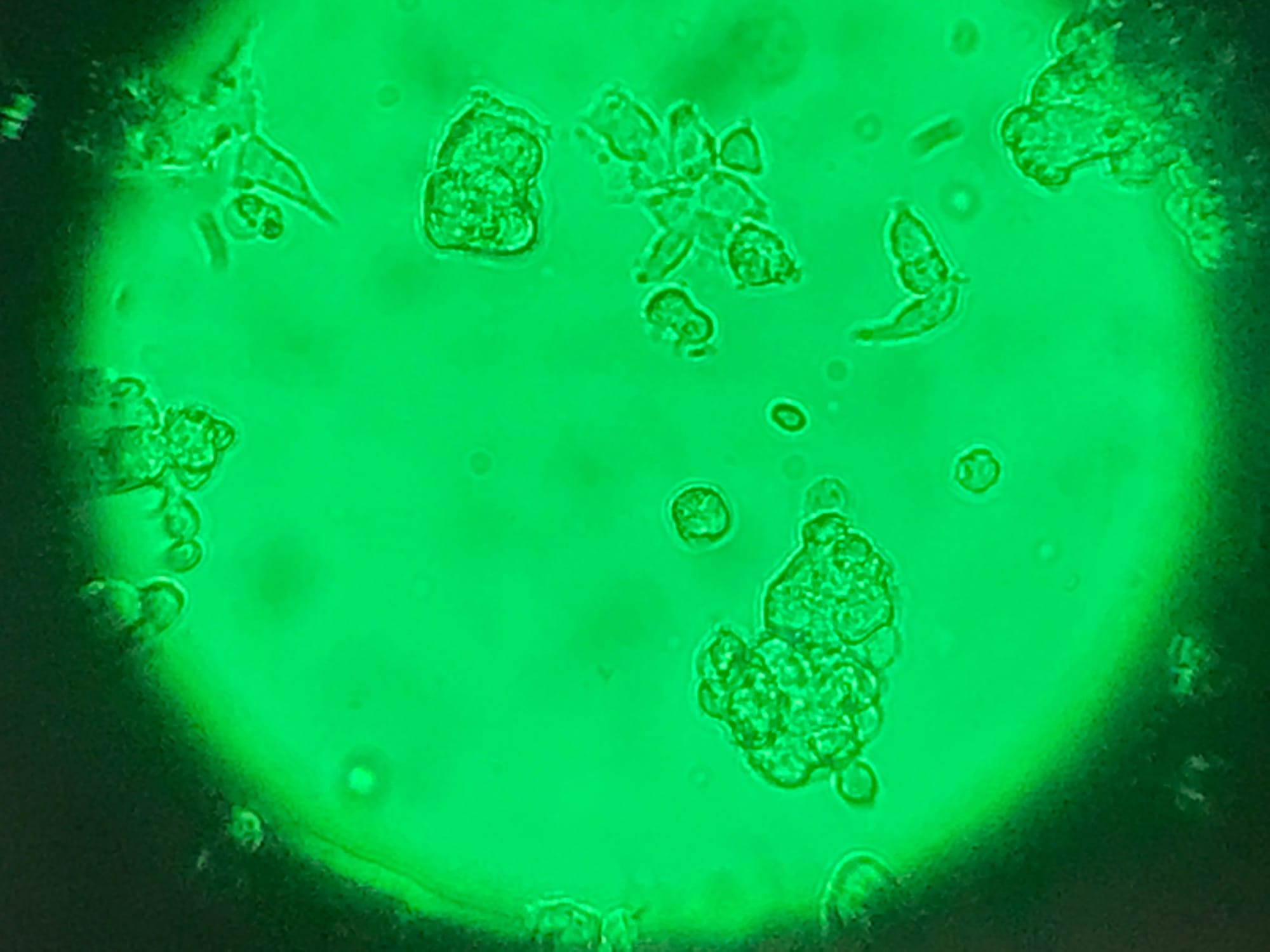 Dr. Wohl brings extensive expertise in preclinical drug development, having established and optimized a range of animal models for malignant glioma studies