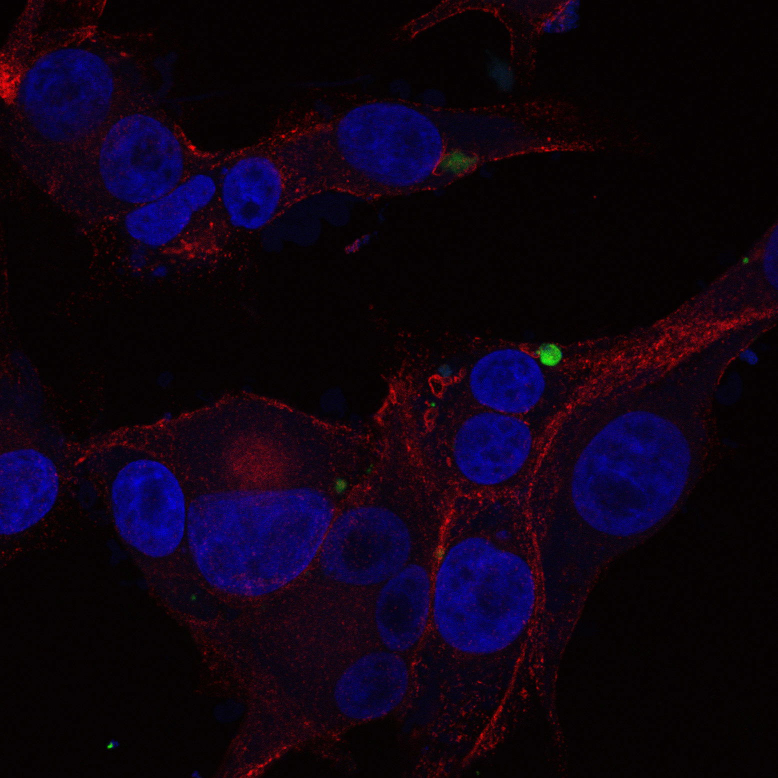 Dr. Wohl brings extensive expertise in preclinical drug development, having established and optimized a range of animal models for malignant glioma studies