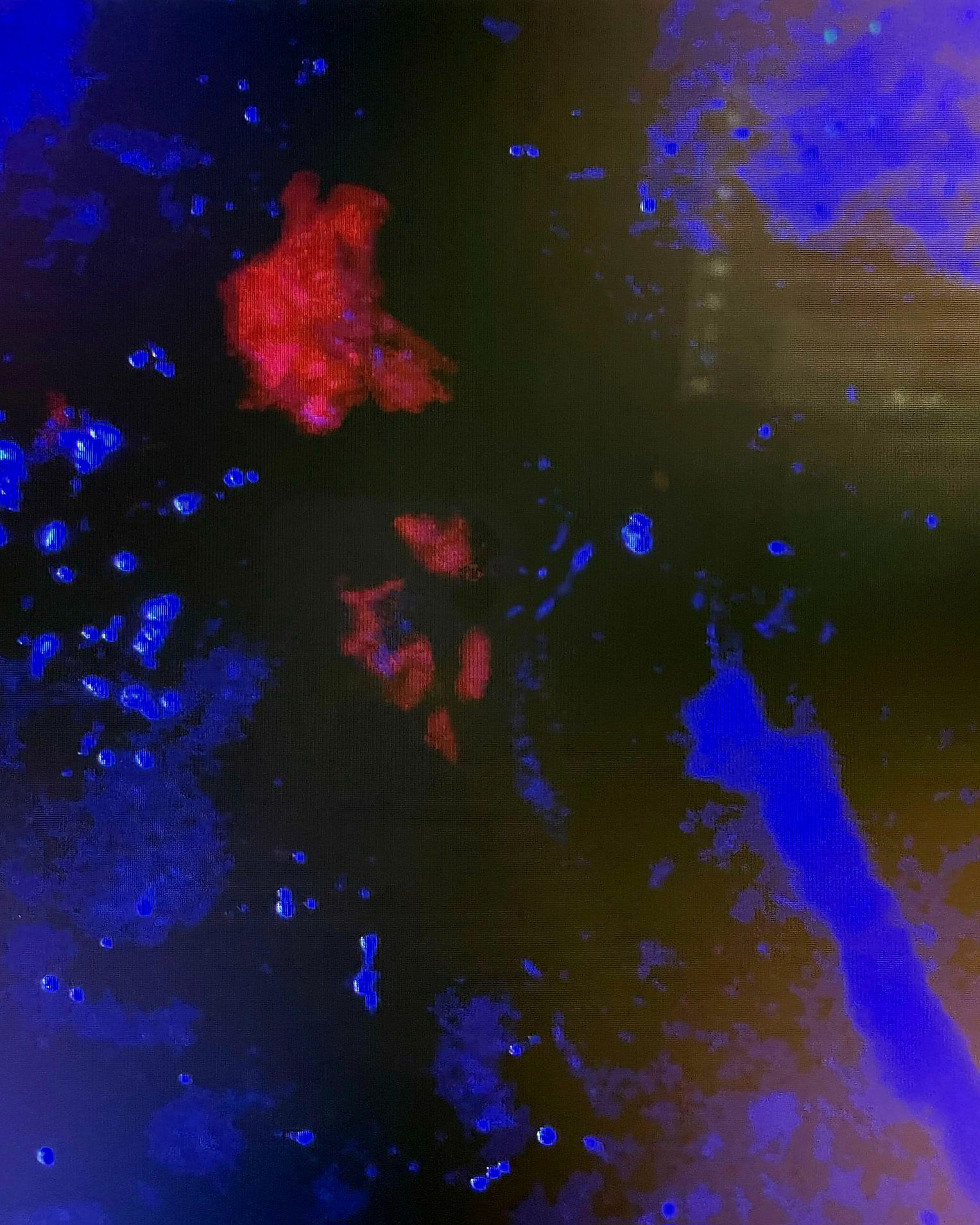 Dr. Anton Wohl is a highly experienced neurosurgeon specializing in neuro-oncology, with a clinical focus on brain tumor surgery and stereotactic radiosurgery