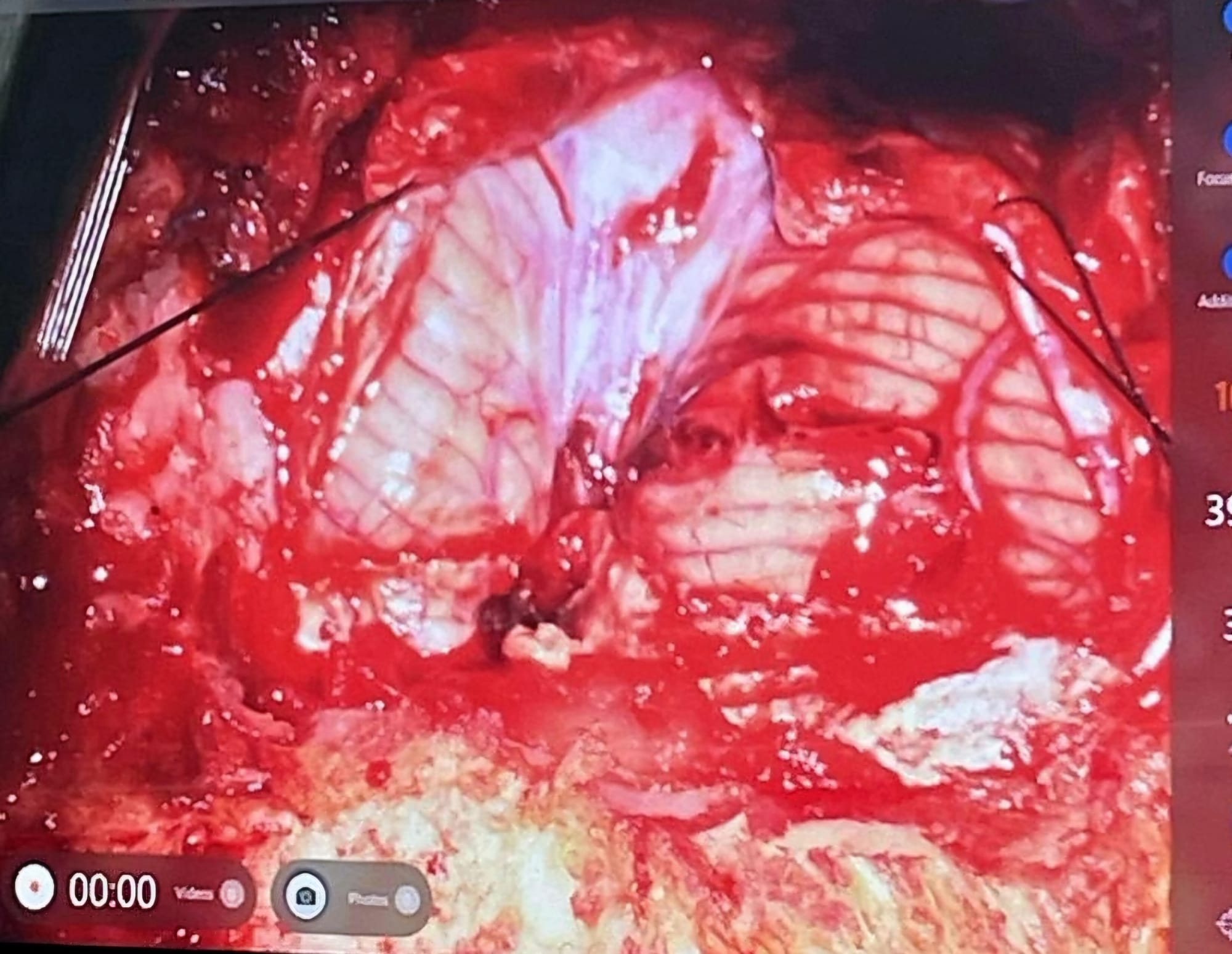 Dr. Anton Wohl is a highly experienced neurosurgeon specializing in neuro-oncology, with a clinical focus on brain tumor surgery and stereotactic radiosurgery