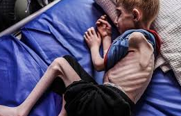 We need to talk about starvation as a weapon