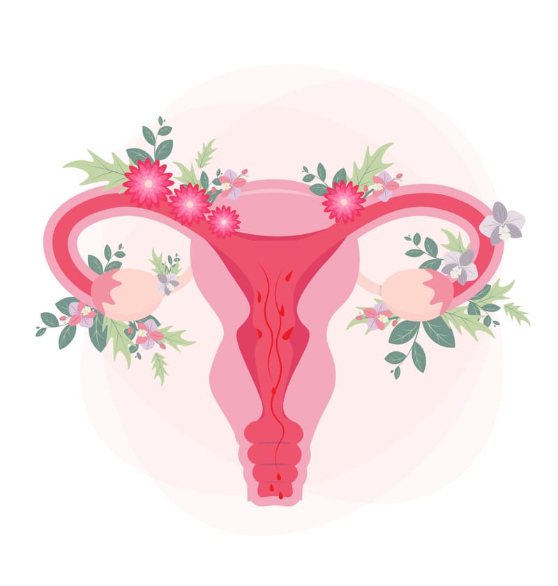 Endométriose & SOPK