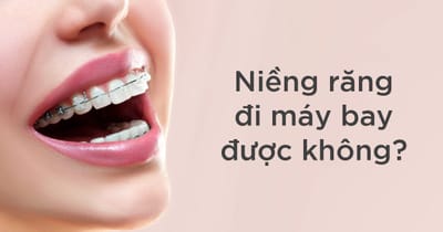 Nieng rang co qua cong an ninh di may bay duoc khong?