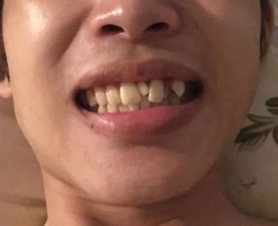 Tuong so nguoi co rang chuot la nguoi nham hiem
