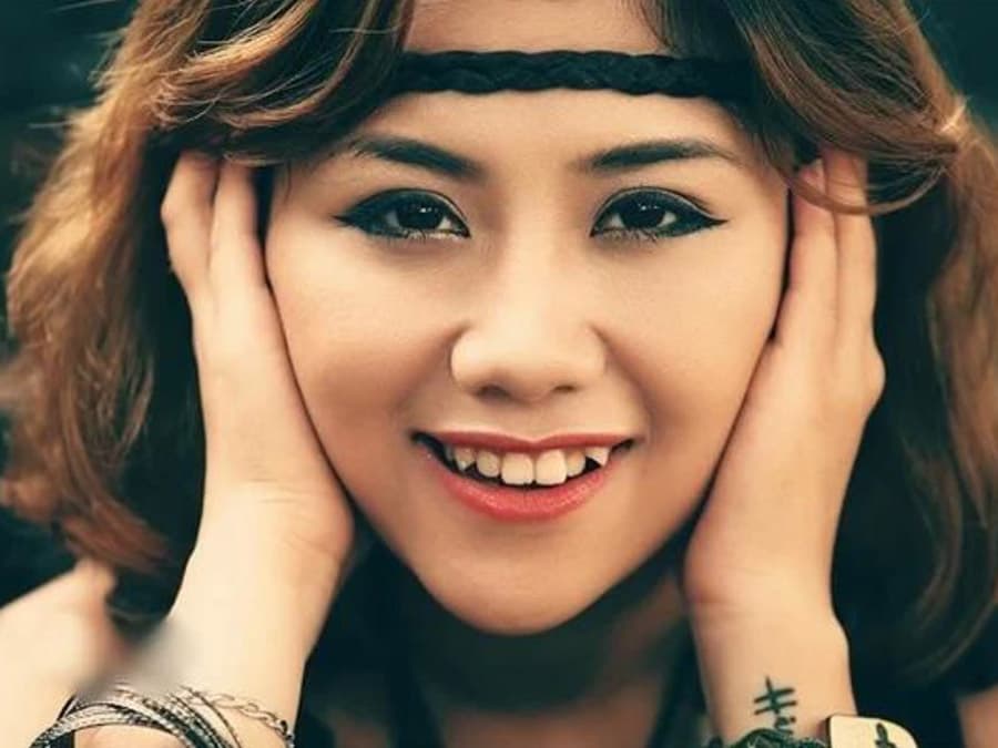 răng khểnh 2 bên