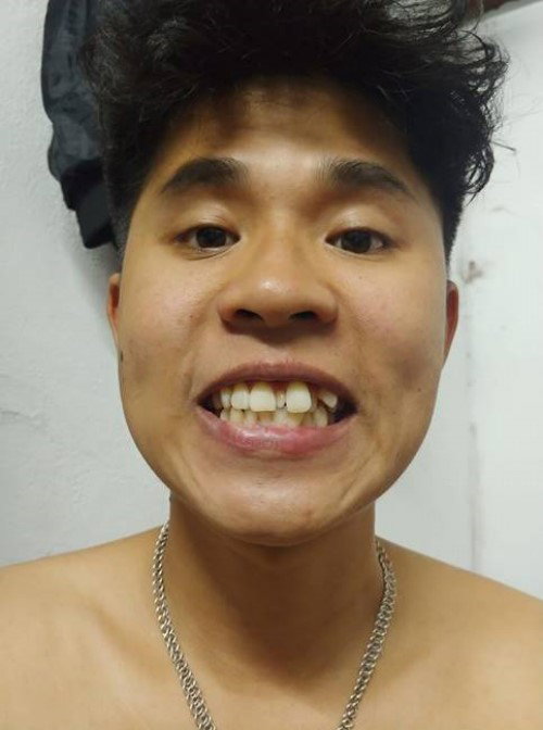 Tướng răng chuột