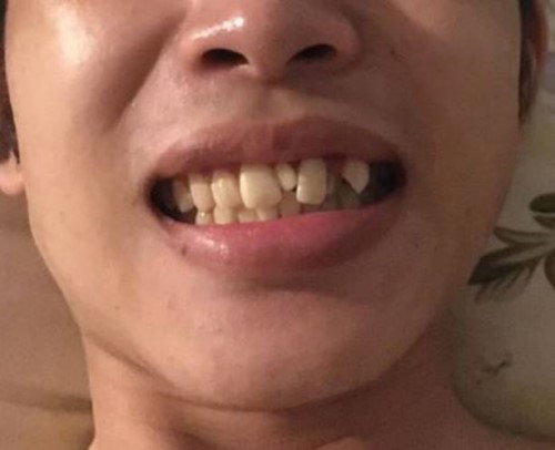 Răng chuột