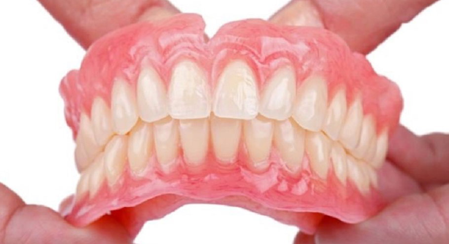 Khớp cắn đối đầu