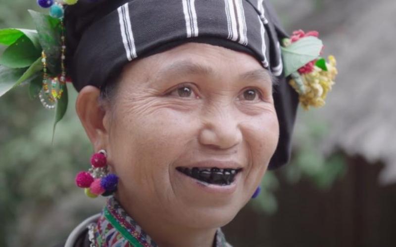 Ăn trầu bị răng đen