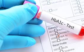 Understanding Your HbA1c Test: Why It Matters for Diabetes Management