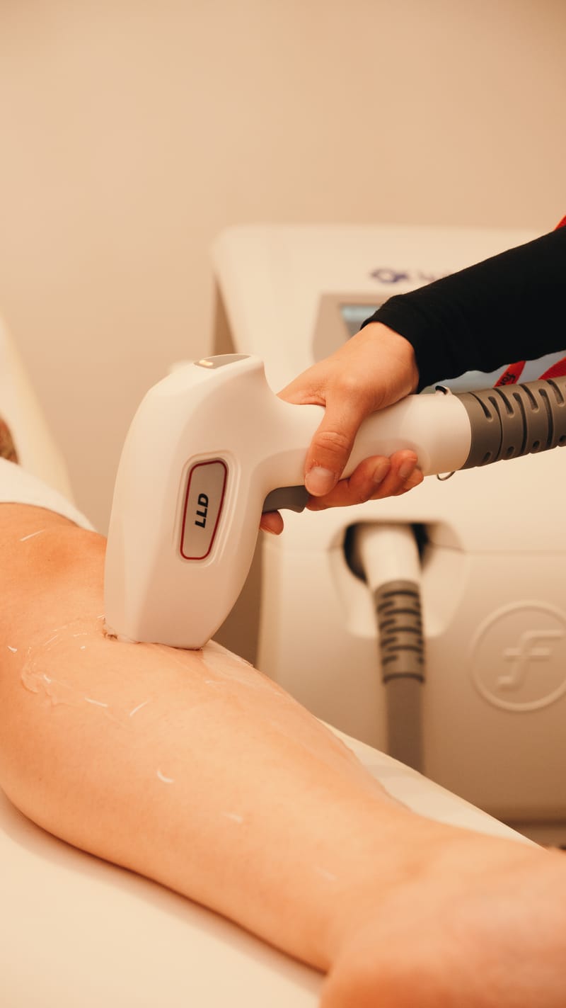 Épilation Définitive - Laser Diode