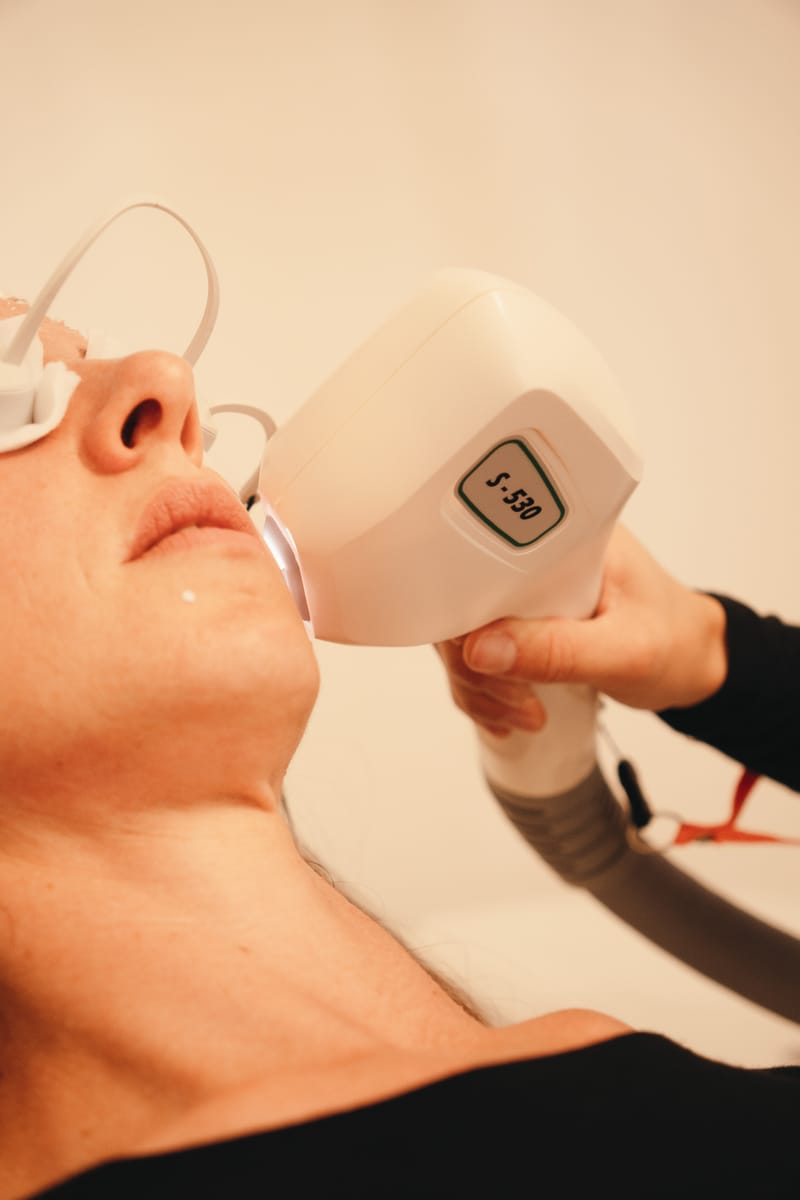 Traitement des tâches pigmentaires - IPL 3D