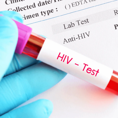 The Ultimate Guide to Diabetes Test Dubai, A1C Test at Home, and HbA1c Test at Home with Health1