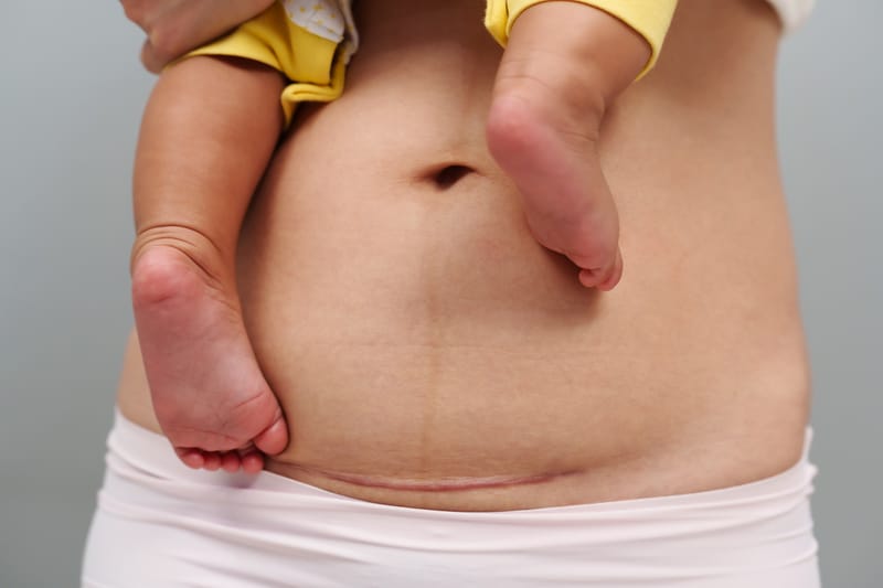 Scar Tissue Therapy