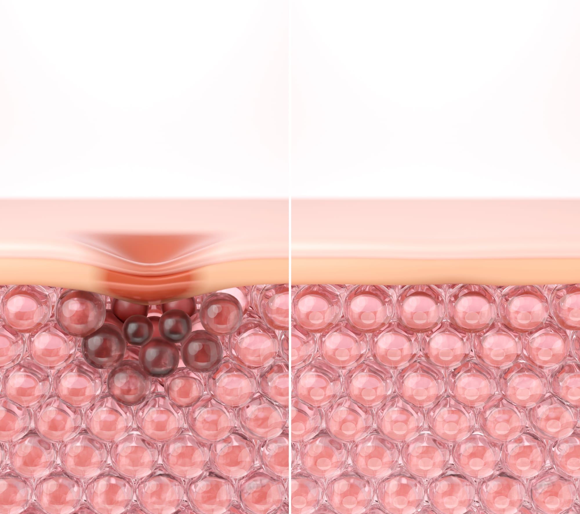 10 Common Questions About Exosome Microneedling, Answered by a Dermatology Clinic