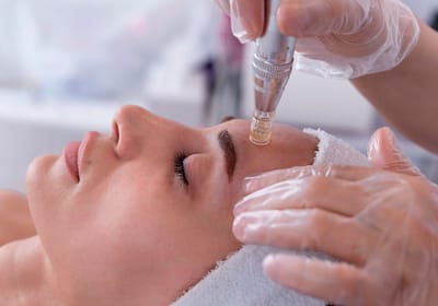 🌟 Unlock Glowing Skin with Microneedling + Salmon DNA in Dubai