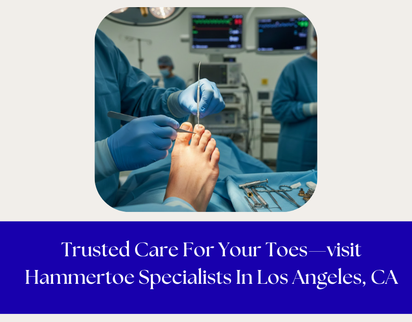 Hammertoe Specialists in Los Angeles, CA