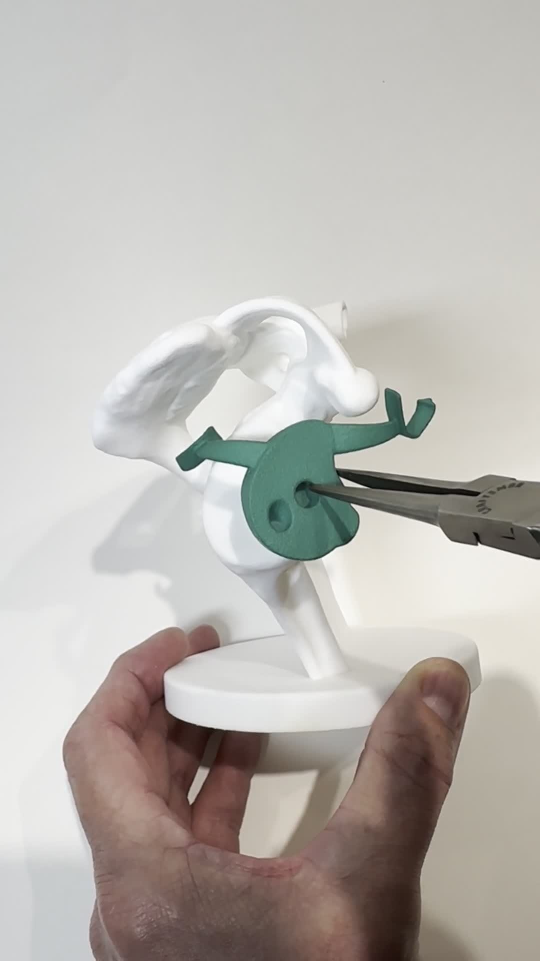 Glenoid Base Insertion thumbnail