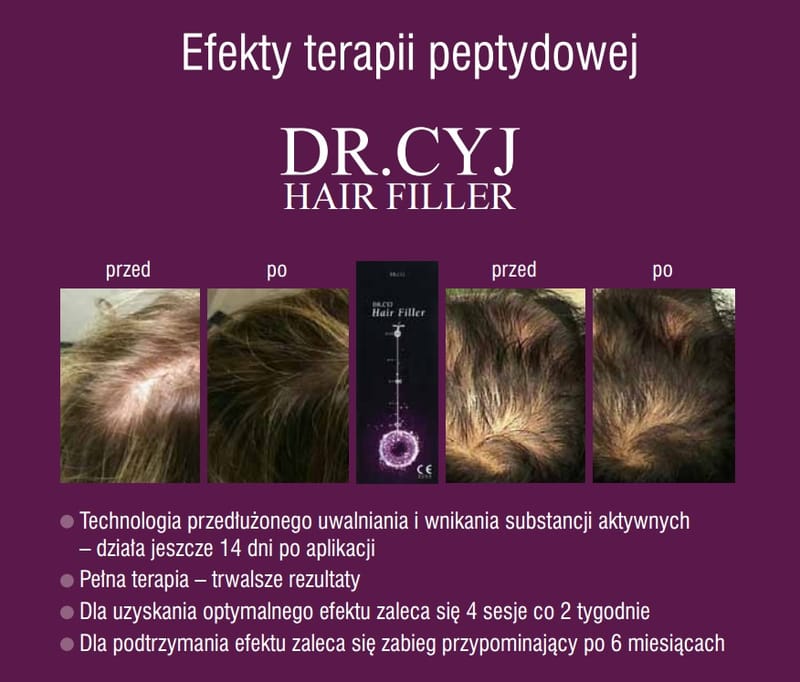 Dr Cyj Hair Filler  - leczenie i terapia wypadania włosów