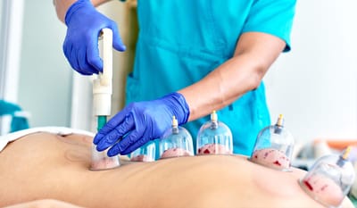Support Your Liver Health with Hijama