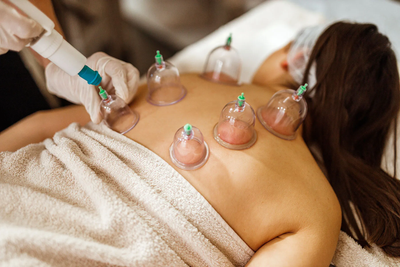 How Hijama Cupping Therapy in Dubai Affects the Nervous System
